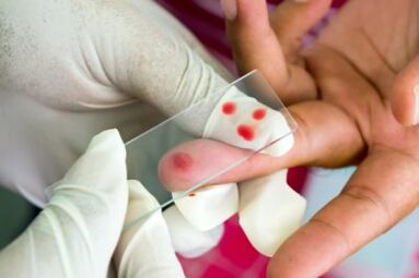 Diagnozė skausmas pirštų sąnariuose