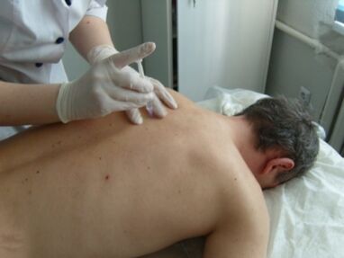 Krūtinės ląstos osteochondrozės chondroprotektorių injekcijos į sąnarį